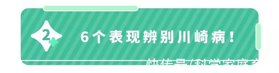 接种疫苗|儿科医生都怕的「川崎病」，究竟有多要命？可能击垮一个家