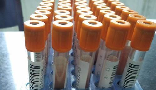 指标|怀疑肝脏出了问题,先要查的是6大指标,一个都不能忽视