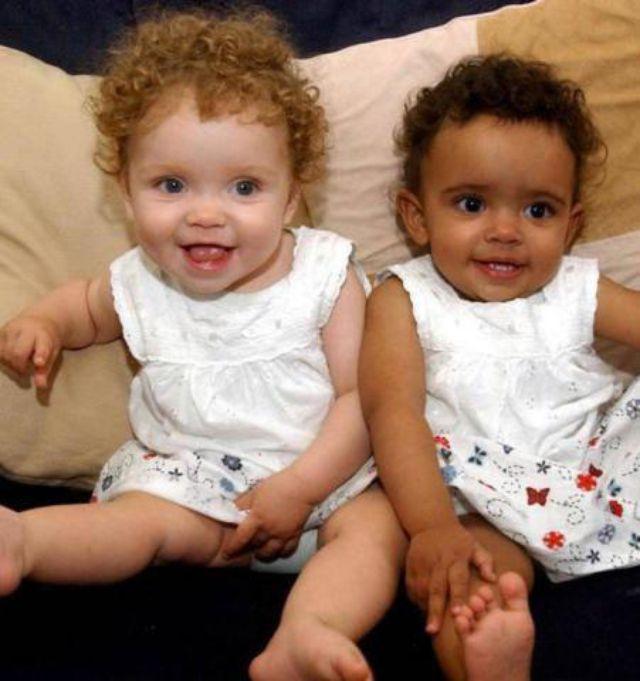 夫妻俩|夫妻俩生下“奥利奥”双胞胎,一个白一个黑差距大,如今成这样