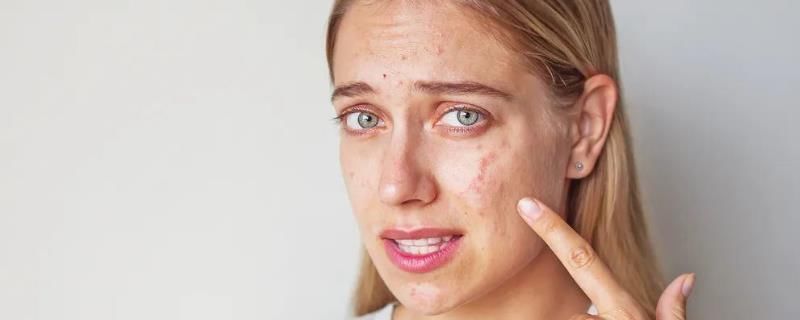 皮肤|皮肤太干敷面膜刺痛怎么办