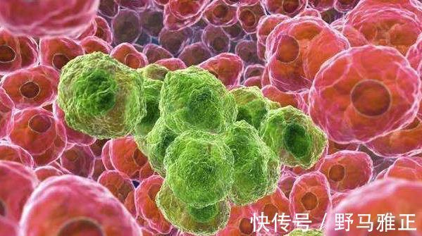 根治|为何癌症至今无法根治？医生给你解答，癌细胞的“生存之道”