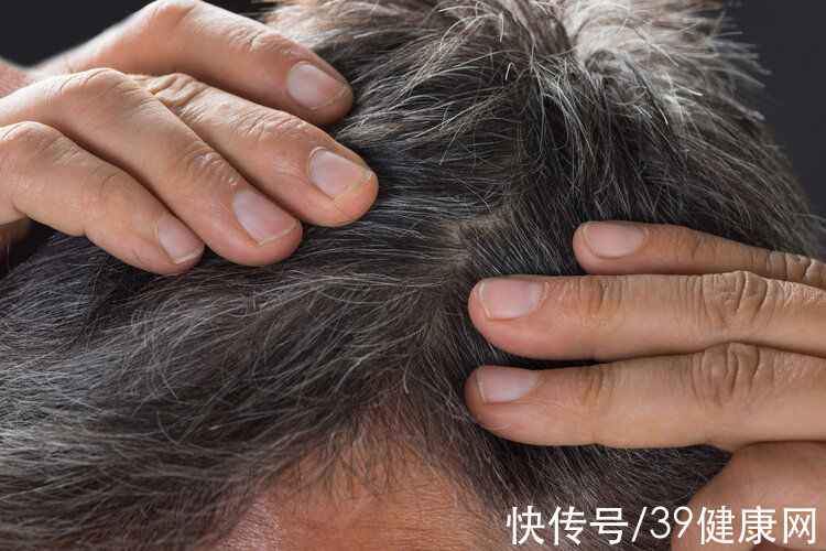患癌|哈佛研究发现：长白发的人不易患癌，真的假的？医生做出了解释