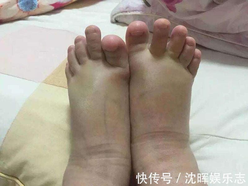 生长发育|孕晚期这3件“尴尬事”,是胎儿在释放健康信号,孕妈不用紧张