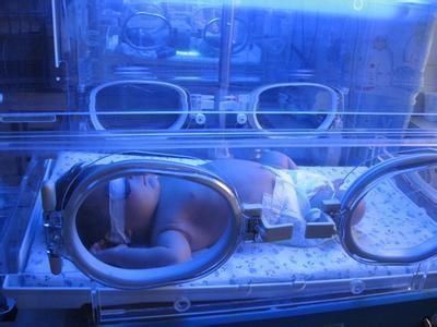 大鱼大肉|2个月宝宝脑出血,医生:大脑有损伤,问题出在妈妈的母乳上