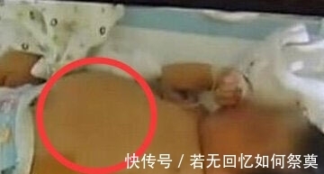 袁捷|【奇闻】孕妇产下“胎中胎”:刚出生8天女婴竟怀孕?