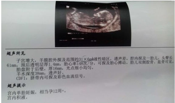 神经系统|怀孕期间,这5项检查能安全通过,说明宝宝健康聪明,准妈可放心