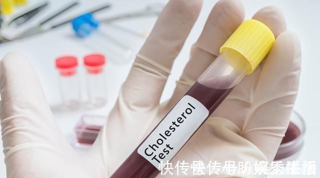 胆固醇|医生血脂这么降最快,2个月甘油三酯降到3.7,高血脂不攻自破