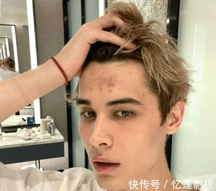 创造营|录节目录的好好的,利路修怎么被救护车拉走了,他发生什么事了?