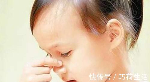 压迫止血法|宝宝容易流鼻血,父母不要再用纸巾塞鼻孔了,用其它的方法止血