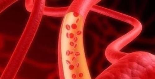 食物|血脂高了别发愁,常吃这6种食物,可以疏通血管,远离“血栓”