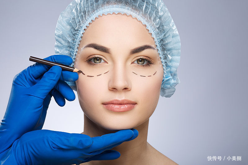 一线城市|割双眼皮容易吗?会不会很贵?