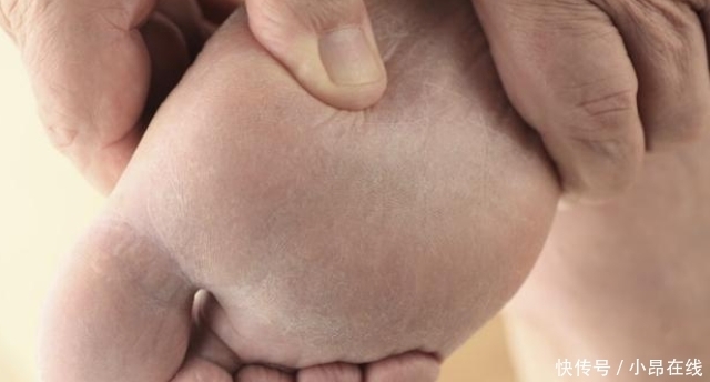 90岁院士研究糖尿病50年,提醒:3种食物或会唤醒糖尿病“因子”