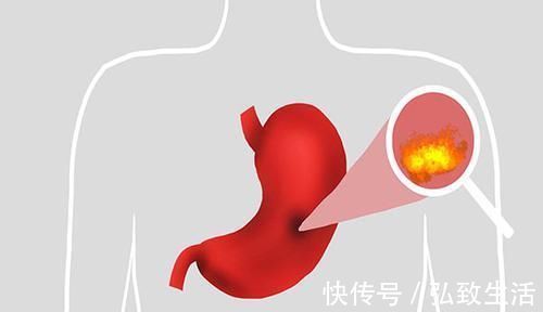 养肝护肝|肝不好的人，“养肝水果”可以多吃，补充维生素，或能修复肝功能