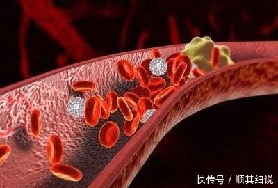 减少|脑部供血不足的人,身体可能有4个表现,不妨自检一下