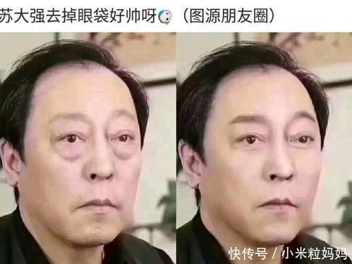 5款公认好用的眼霜推荐,零鸡肋不踩雷,告别智商税,孕妇也可用