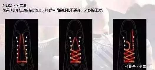 跑步鞋 专业运动员系鞋带方法，走路跑步感觉完全不一样，试过就知道舒服