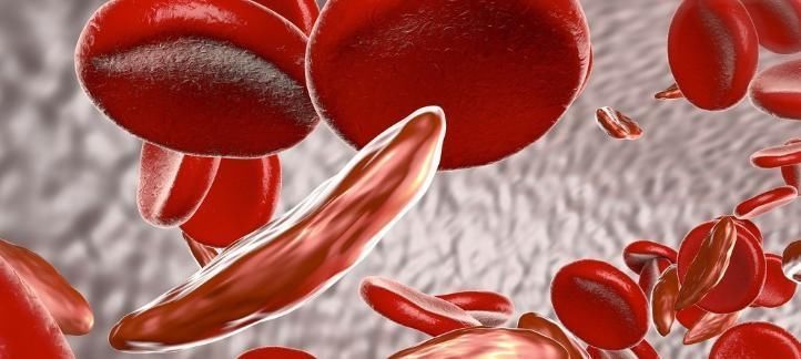 体位性低血压|蹲下时突然起身，最容易发生晕眩，其实是此病正在作怪