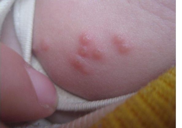 宝宝|宝宝突然身上掉皮,妈妈却不敢抱他,医院检查后,宝妈很尴尬了