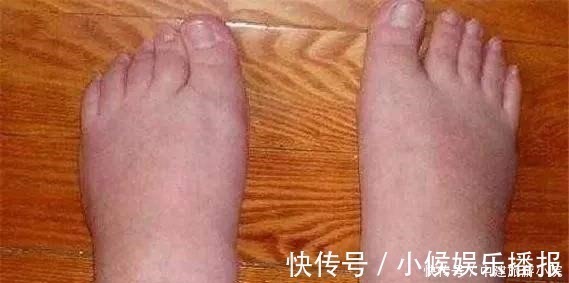 部位|怀孕后,不止肚子变大,某些部位也会“疯长”,多数孕妇都逃不过