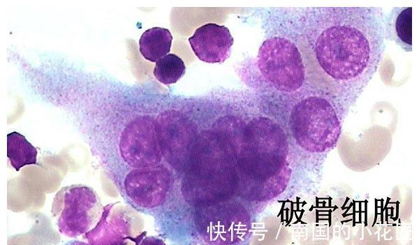 成骨细胞|还有多少人相信喝骨头汤、吃虾皮能补钙？告诉你真正补钙的方法