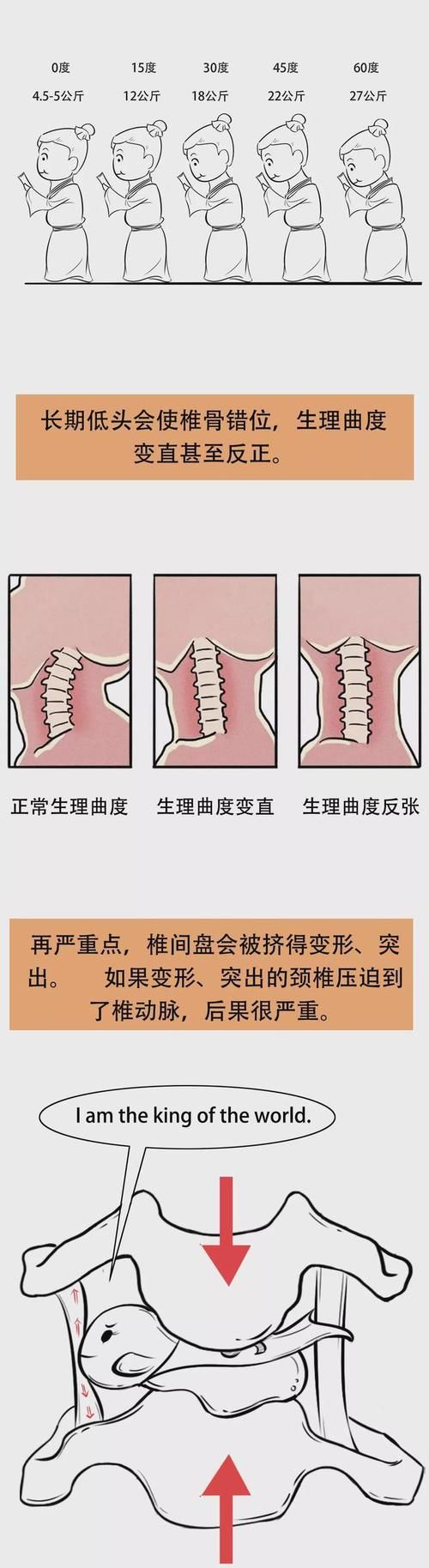 颈部|你的颈椎是怎么坏掉的,附颈椎保健操!