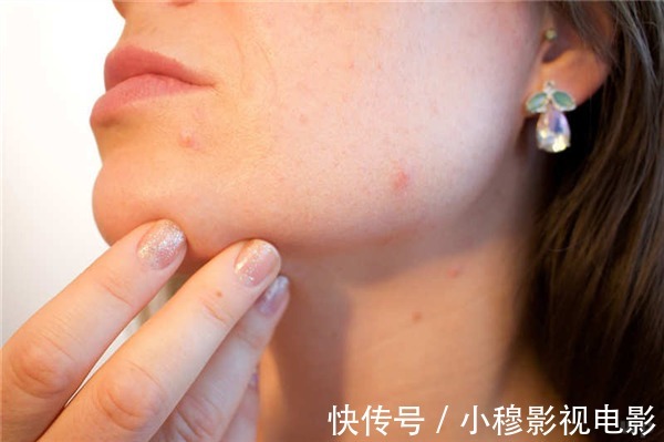 酒精肝|肝好不好,身体会说实话,若一个没中,你的肝很健康掉