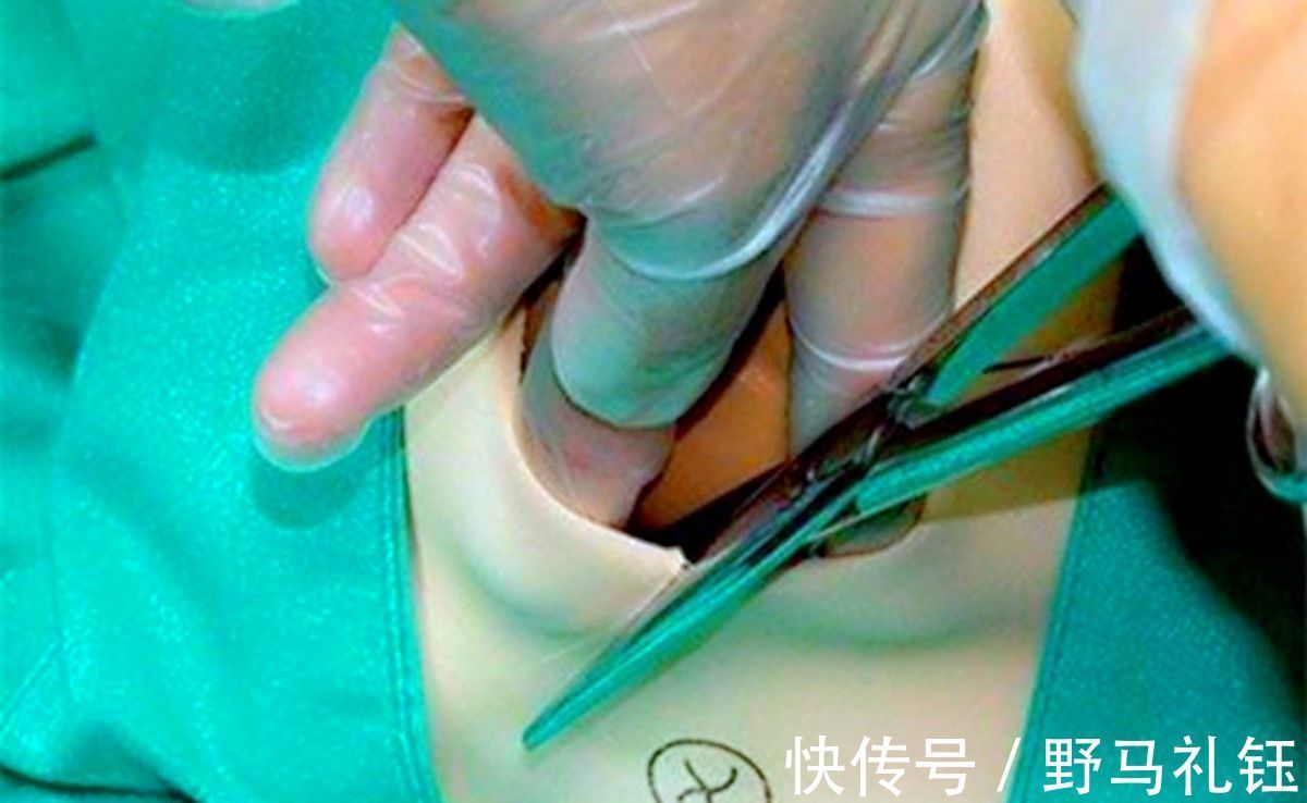 二胎|产检时,医生总问“头胎还是二胎”,这其中的“玄机”你知多少?