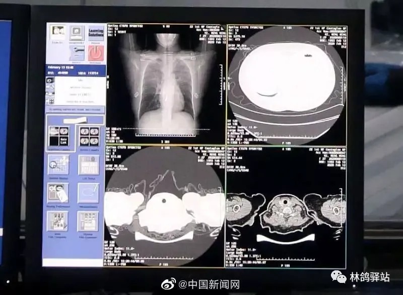 路透社|面对疫情，AI的用武之地都有哪些？