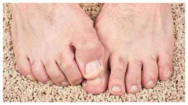 肾脏|“肾”好不好看脚,若脚上没有这3种迹象,可能你的肾保养的很好