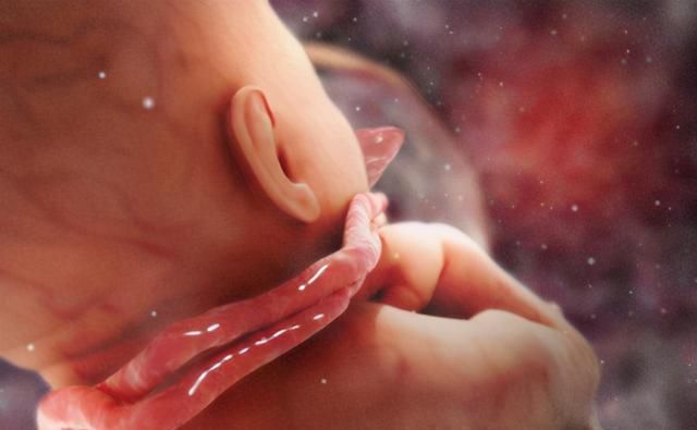 脐带|顺产好处虽然多,但需要孕妈满足六个条件,不可盲目选择