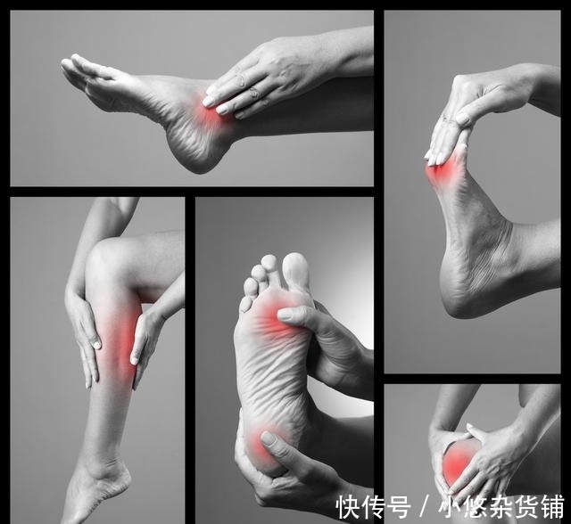  阶段|痛风分阶段，这4个阶段的痛风，你都了解吗？