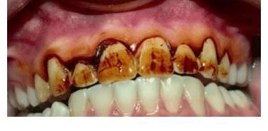 腌菜|26岁高管坚持跑步,肝癌离世,肝胆科主任:运动后“1习惯”要不得