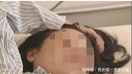 医生|孕妇查出癌症后舍命保孩子 几周后肿瘤突然破裂 医生傻眼了