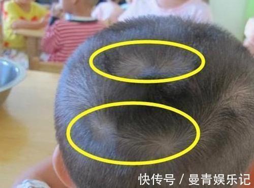 毛发|为什么有的孩子头上有“2个旋”?代表什么意思,父母要知道