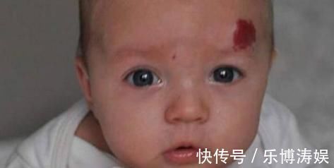 胎记|怀孕后的几件事一定要避免,为了孩子以后的容貌,再喜欢也要克制