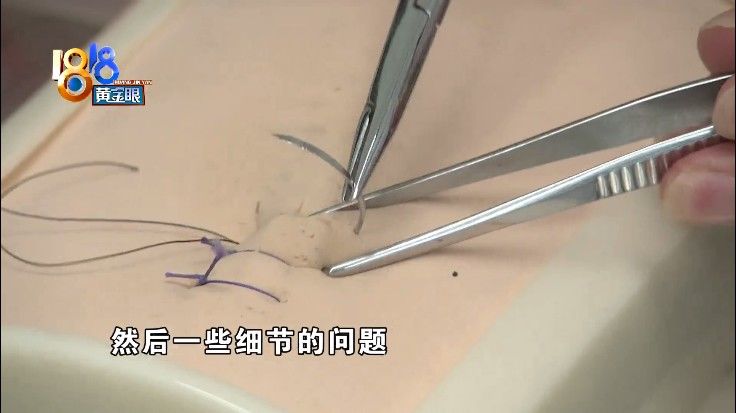 唇腭裂|医术精湛的专家，最牵挂那曲的孩子