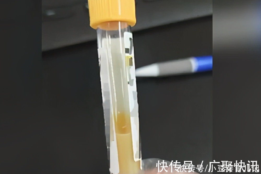 健康饮食|孕妈一天四次外卖,炸鸡麻辣烫轮番吃,如今血如“牛奶”危害胎儿