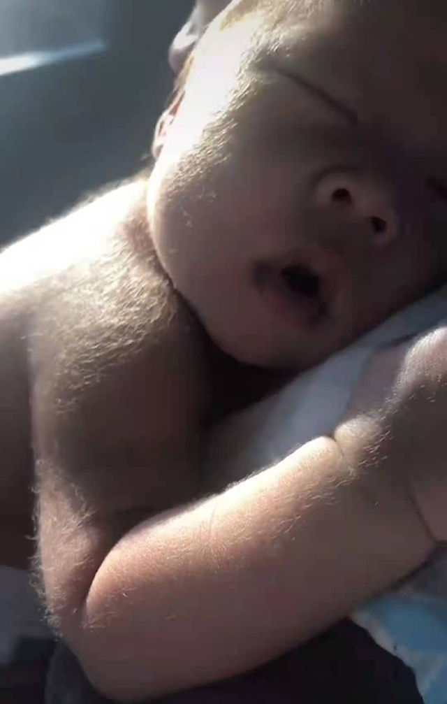 照片|宝妈吐槽自己生了一颗“猕猴桃”,晒出宝宝照片后,网友恍然大悟