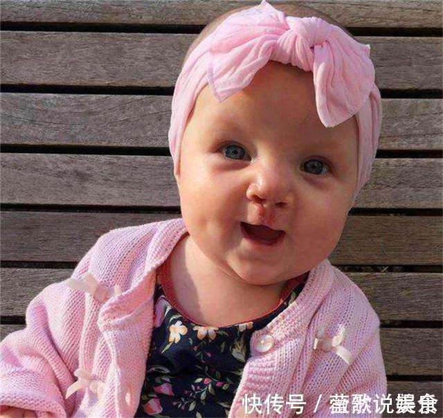 宝宝|24岁宝妈生下“兔子宝宝”,丈夫劝她放弃,手术后妈妈掩面而泣