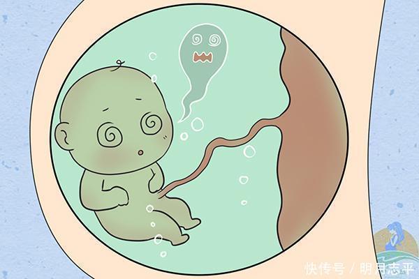 羊水|孕期羊水浑浊容易伤宝宝！做到4不碰，可让羊水保持清澈！