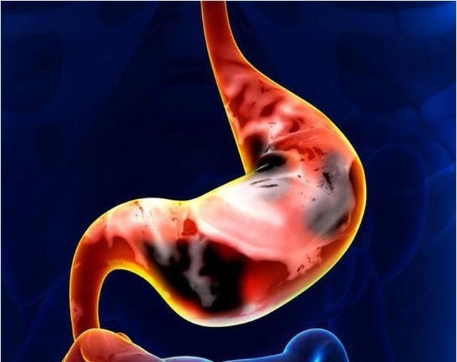 检出率|胃不好的人,少碰二菜,多吃三红,远离四事,胃会越来越好!