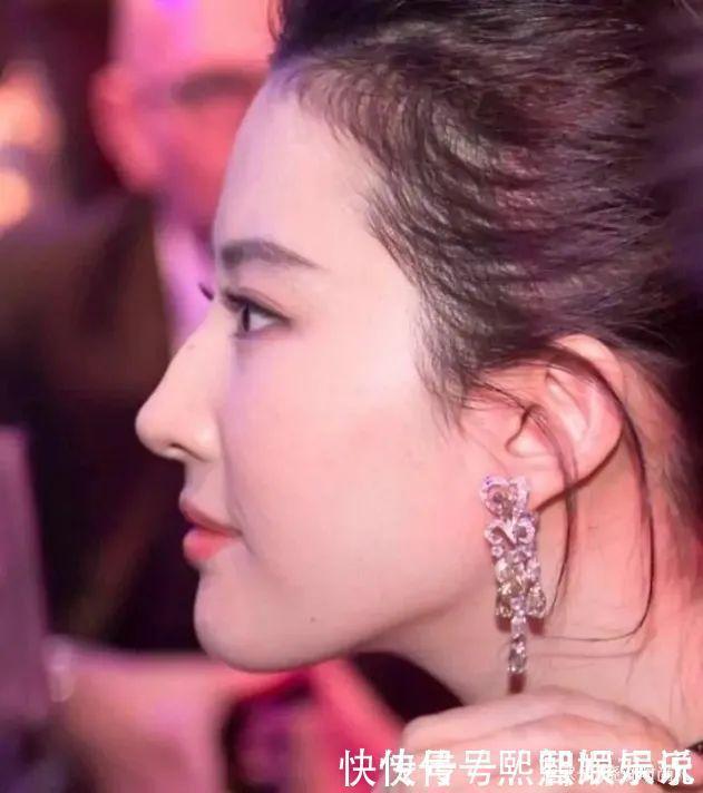 蒜头鼻|五种公认的“丑鼻型”,蒜头鼻、驼峰鼻都上榜了,第一个最常见