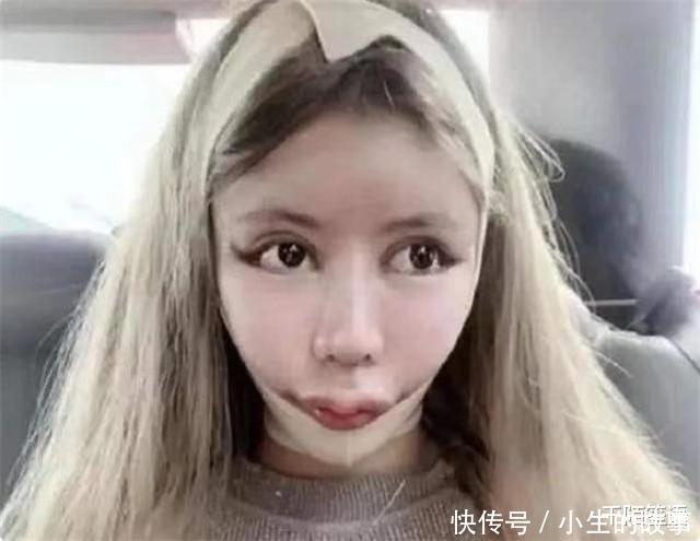3年花费近百万,整了60次容的“网红”娜娜,现在过得怎么样