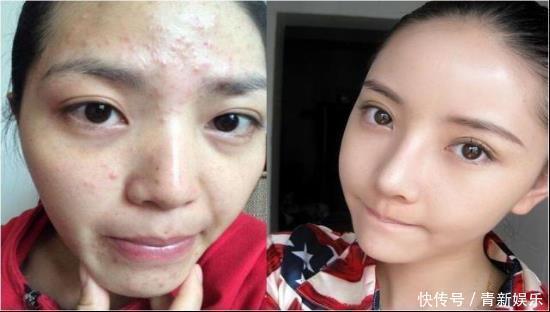 毛孔|坚持素颜和每天化妆的女人,坚持10年后,皮肤有什么区别
