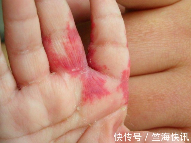 女人|女人怀孕后,尽量不要做4件事,以免宝宝脸上长胎记,别不当回事