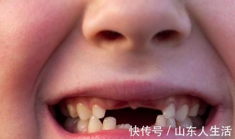 攻略|如果你的宝宝正在换牙,那么这份攻略你就得仔细看看了