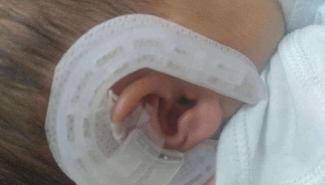 胎儿|按时产检却生下“畸形儿”这些问题检查时很难发现,孕妈要知道