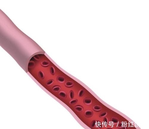 部位|身体里面如果血管堵了,这几个部位会向你发出信号的!