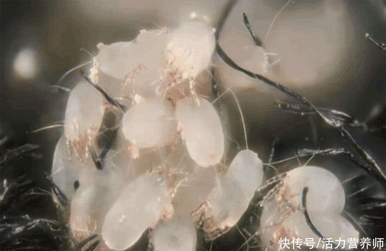 从鼻子上挤出来的白色物质，到底是什么？告诉你答案和处理办法