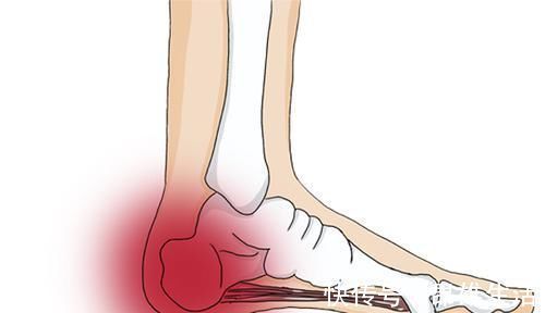 足部|更年期女性脚部总疼是咋回事？医生提醒：多半是2种病，要排查下